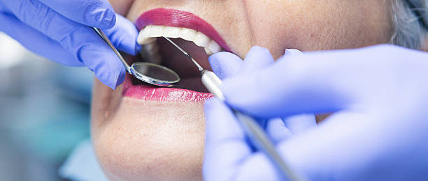 Best Dental Abscess Treatment in Aquebogue, NY